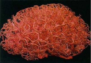 frankenstein - 3d printed vasculature blood vessels