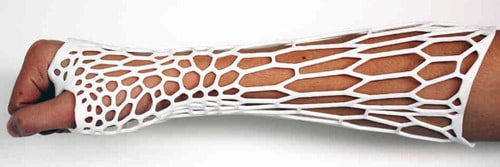 3d printed casts and bioactive clothing