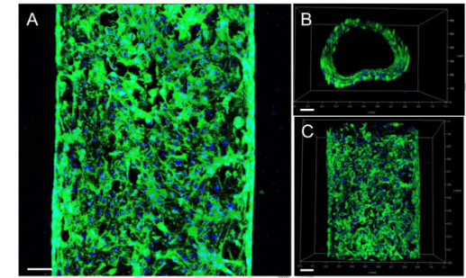HUVEC vascular channel vein 3d bioprinted bioprint allevi NJIT guvendiren