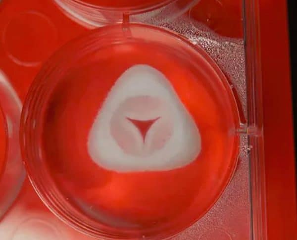 allevi advanced biomatrix collagen aortic pulmonary heart valve bioprint 3d bioprinted