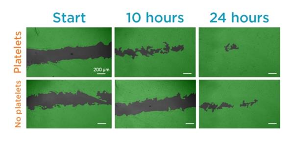 platelet-rich-bio-ink-could-boost-healing-of-3d-printed-tissue-implants-and-skin-grafts-allevi